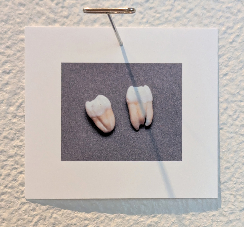 two teeth